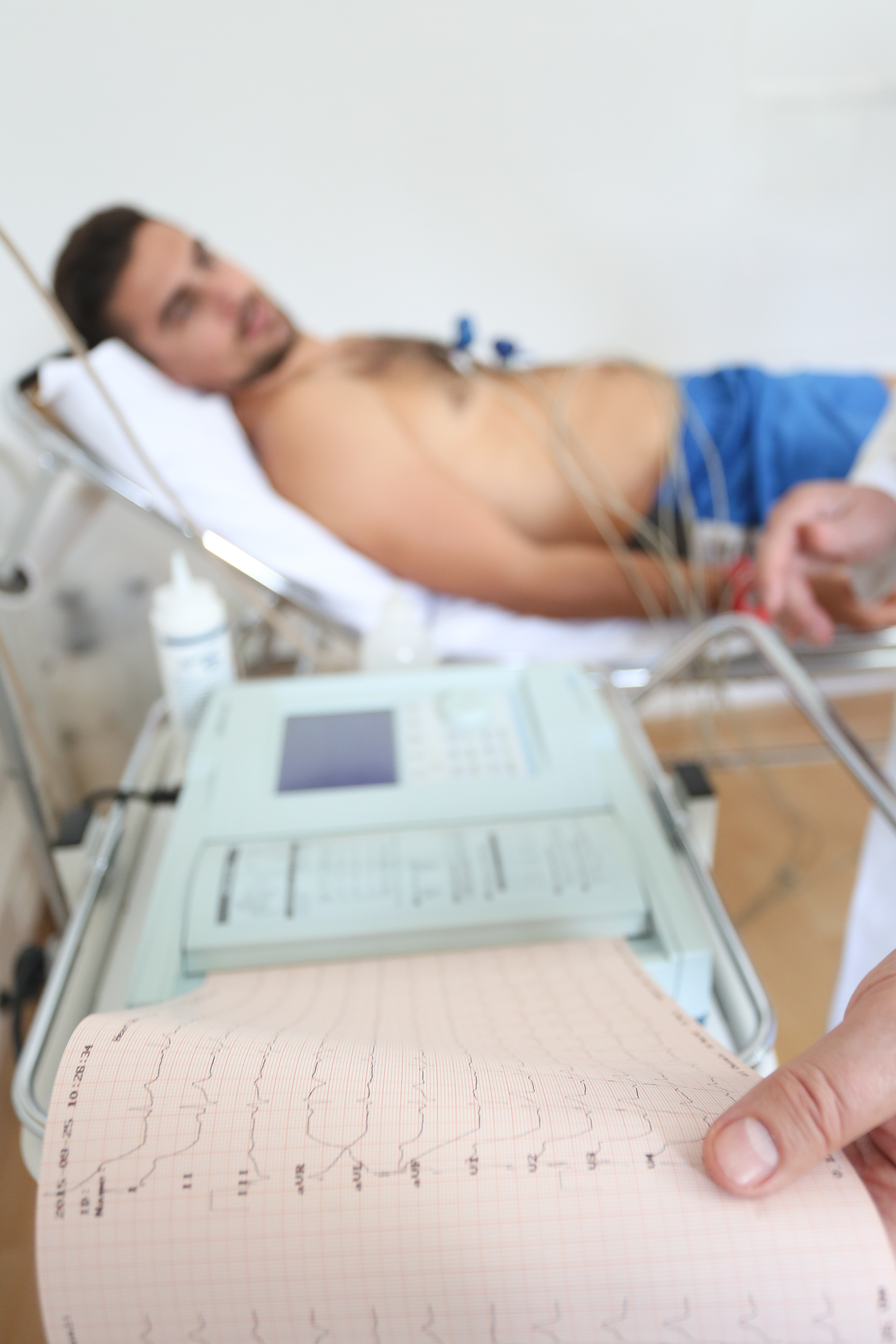 EKG