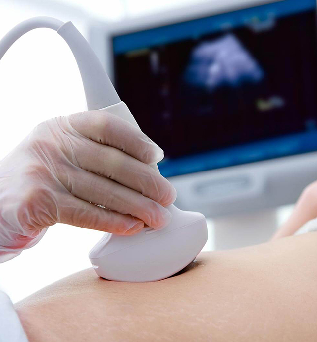 Abdominal ultrasound